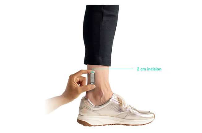 altaviva ankle image_blog home banner